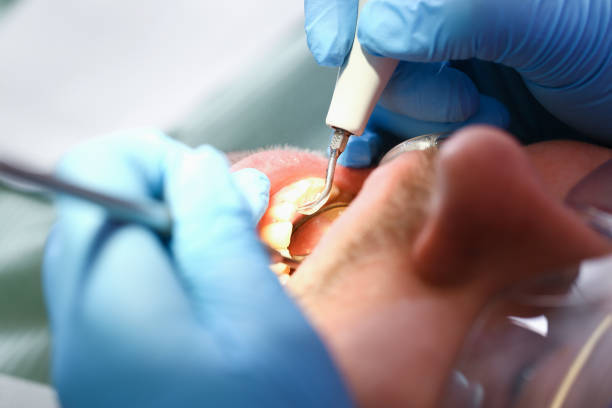 Best Emergency Dental Care for Broken or Chipped Teeth in Alamae, NC