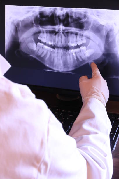 Best Emergency Tooth Extraction in Alamae, NC